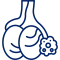 Varicocele e Hidrocele